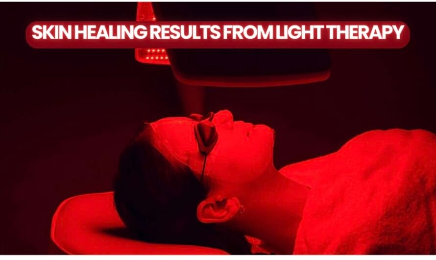 Skin Healing Results From Light Therapy- A Deep Dive Into The Treatment